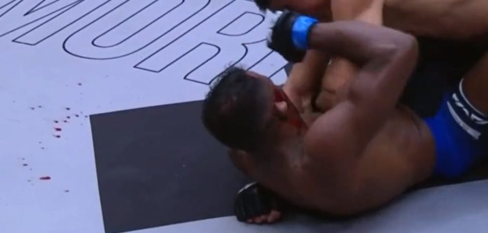 Vinicius Cruz Ear Trauma: How MMA Fighters Deal with Cauliflower Ear